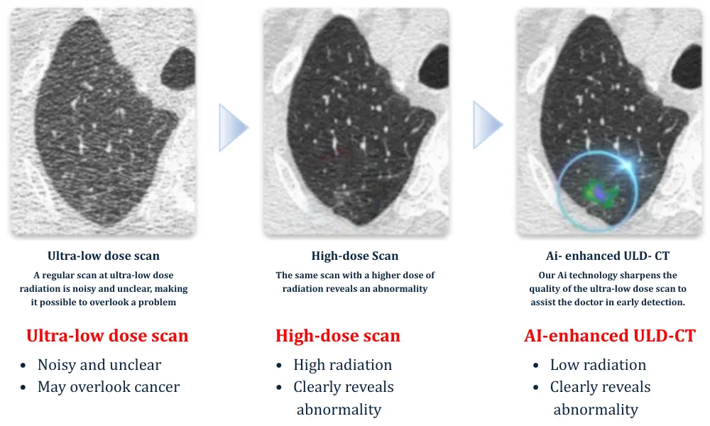 image of comparison of Ai enhanced ULD- CT with other scanning systems