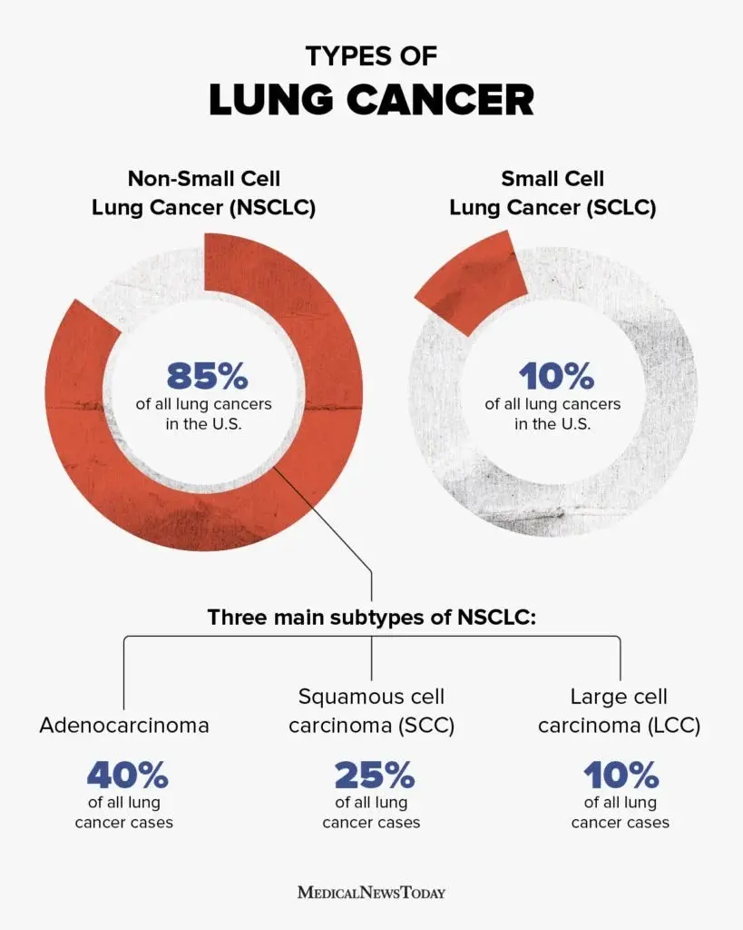 types of lung cancer