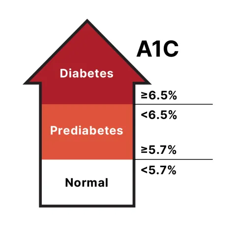 image showing prediabetes may be identified through an HbA1c level of 5.7% to 6.4%, a fasting plasma glucose level of 100 to 125 mg/dL