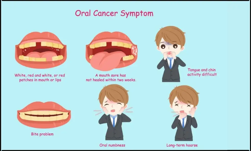 image of oral cancer symptoms