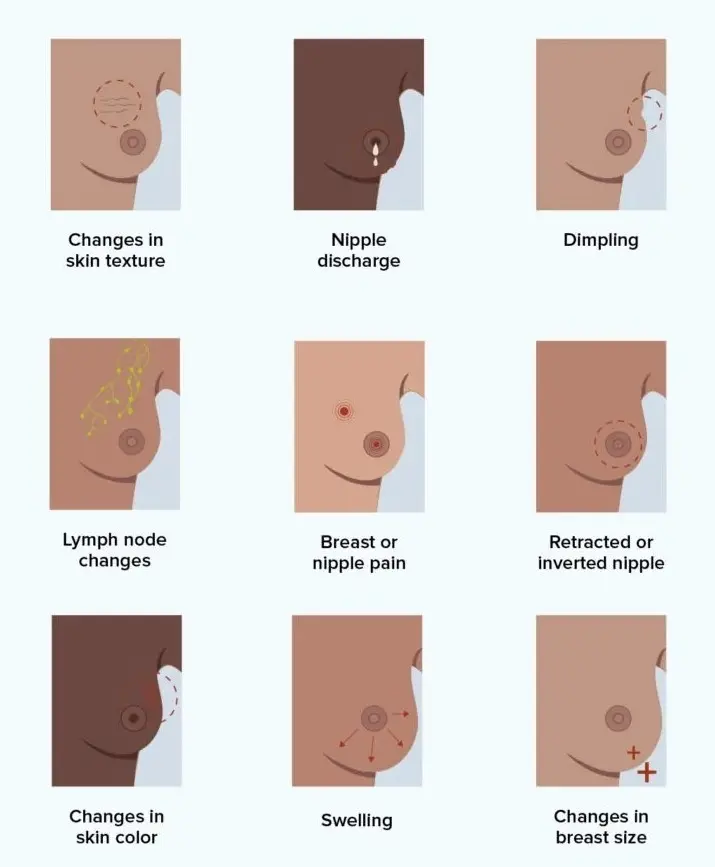 Common Symptoms Of Breast Cancer