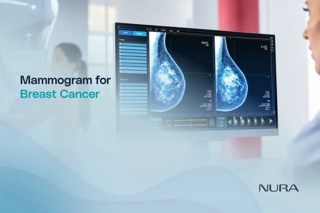 Mammogram for Breast Cancer When Is It Needed