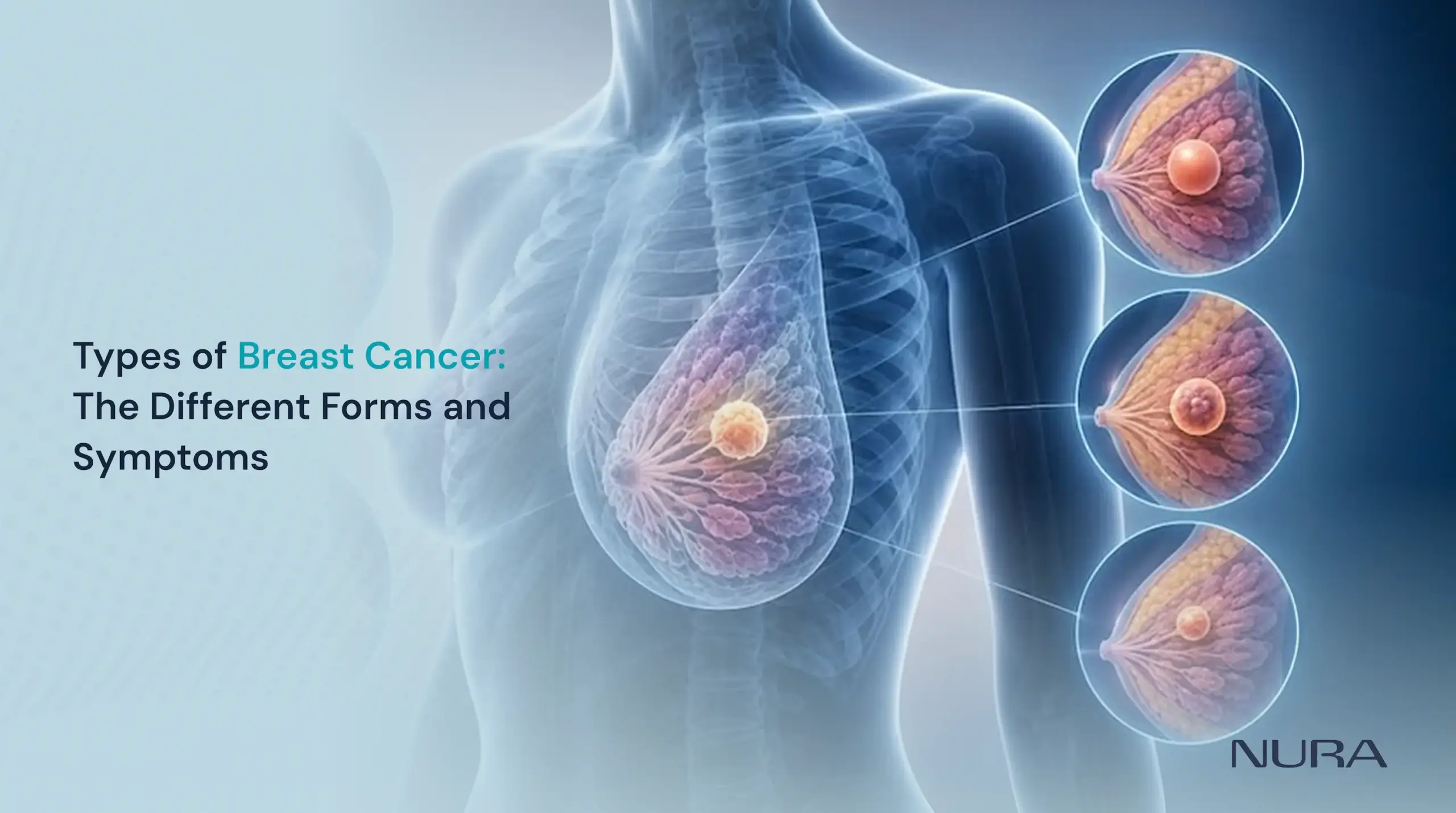 types of breast cancer symptoms