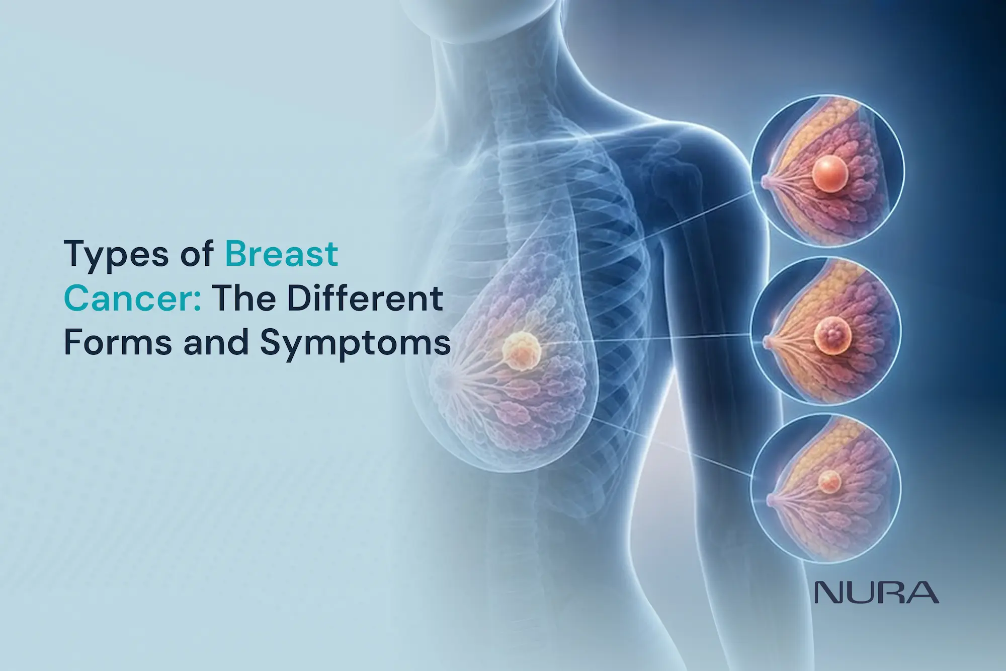 types of breast cancer symptoms