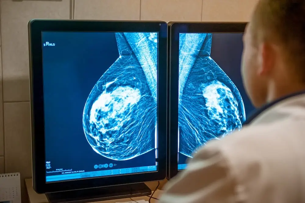 Why Is Mammography Important for Breast Cancer Screening?